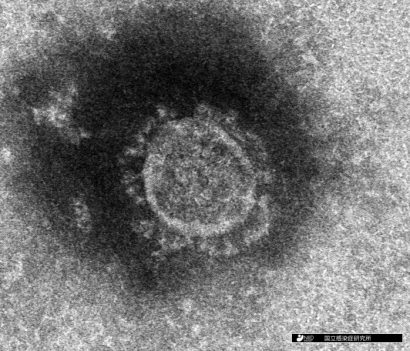 【速報】新潟県内で新たに７名の新型コロナウイルス感染患者を確認