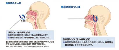 デンカ（株）、インフルエンザウイルス抗原迅速診断キットの一部変更承認を取得、検査体制の充実に期待