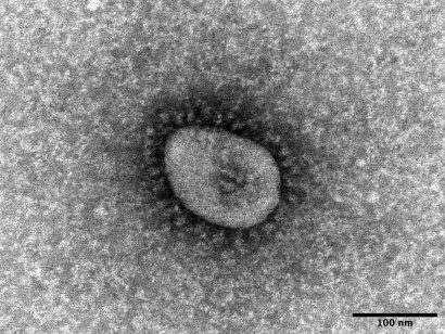 【速報】新潟市を含む県内で新たに261人の新型コロナウイルス感染症患者を確認、うち新潟市は90人